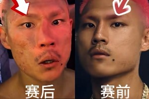 惨遭“整容”！恶鼠遭威姆斯TKO 鼻梁骨被打歪鲜血直流